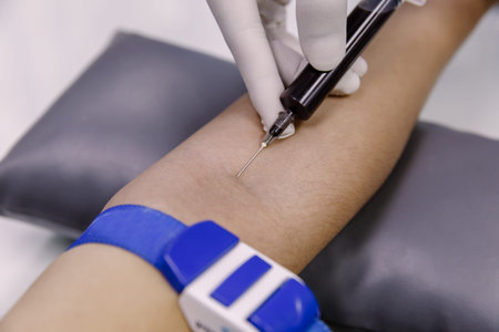 The procedure use needle of Blood collection from the patient's arm...