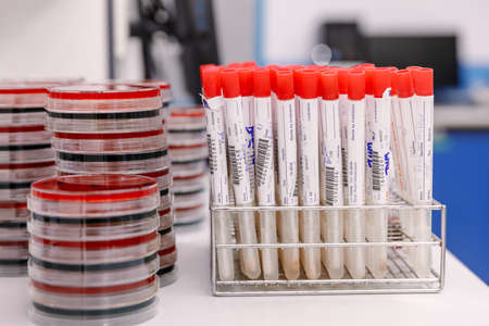 Close-up of test tubes arranged on a tray in medical laboratory. Medical healthcare analysis in a hospital. Biology analysis for immunity viruses..の写真素材