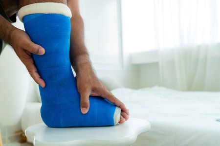 The man's hand was holding the right leg that had suffered a fractured bone and put a blue cast...
