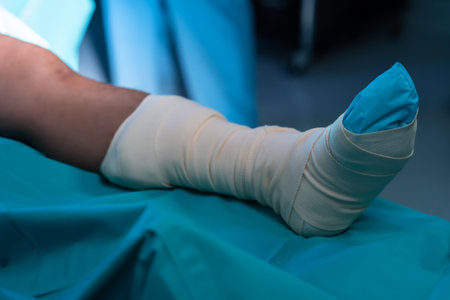 Close-up left leg with knee problems, lie straight on operating room bed with legs straight, leg was wrapped in gauze, doctor prepares before doing surgery on patient with knee disease.の写真素材