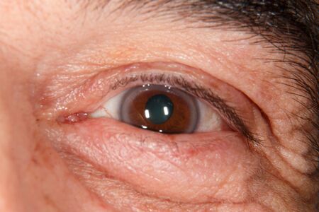 Brown eye with hoopの写真素材