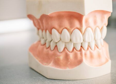 Mould of human teeth. Oral health concept. Mould of human teeth. Close up dental gypsum model. Plaster cast human jaws prothetic laboratory. Oral health conceptの写真素材