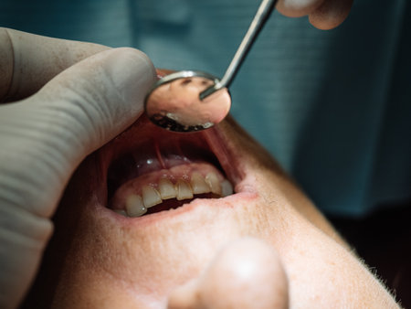 Dentist opens the mouth of his patient and begins to revise the interior helped by his instrumentsの写真素材