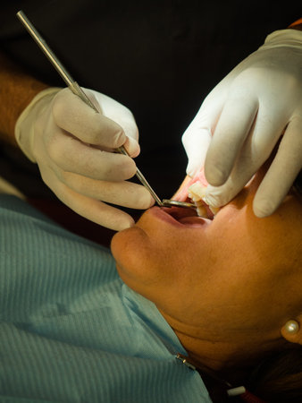 Dentist opens the mouth of his patient and begins to revise the interior helped by his instrumentsの写真素材