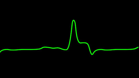 Pulse of the heartbeat green color. EKG Monitor. Heart beat cardiogram, heart monitor EKG electrocardiogram pulse. 3D animation.の写真素材