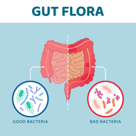 Good and bad gut bacteria: comparison between healthy intestine and unhealthy intestineのイラスト素材