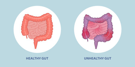 Healthy clean gut and unhealthy inflamed gut comparisonのイラスト素材