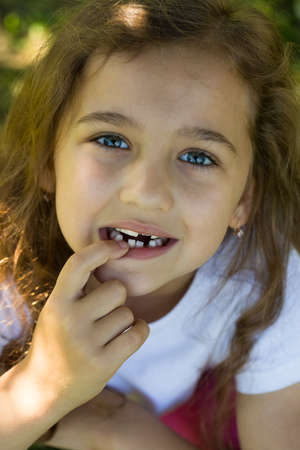 Portrait Of Cute Little Girl Shows, Pointing With Her Finger, Her Baby Teeth Outdoor Close Up.