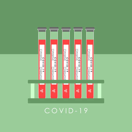 LABORATORY TESTS FOR DETECTING CORONAVIRUS IN THE VECTORのイラスト素材