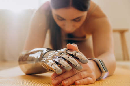 Woman with bionic prosthetic arm does yoga at home on a mat on a sunny day with a modern fitness...
