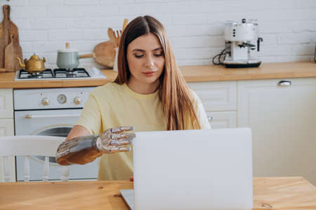 Injured woman opens laptop by metal bionic arm at table