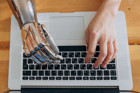 Woman uses metal bionic arm to type on laptop keyboard