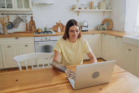 Young woman with bionic arm works surfing internet on laptopの写真素材