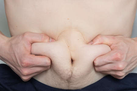 Man holds folds of fat on his stomach with his hands close up