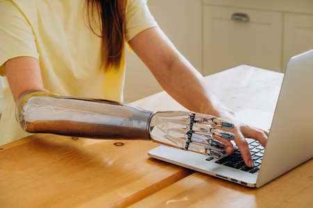 Woman uses metal bionic arm to type on laptop keyboardの写真素材