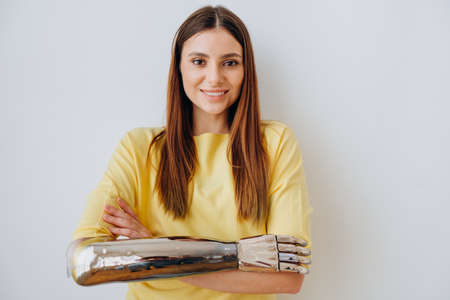 Smiling woman with elegant bionic prosthesis arm on greyの写真素材