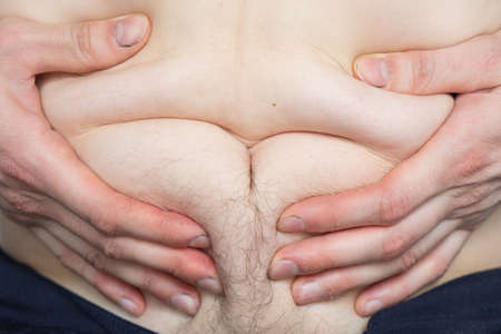 Man holds folds of fat on his stomach with his hands close upの写真素材