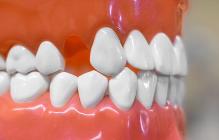 Close-up of a dental jaw with one missing tooth. Artificial human jaw with teeth anatomy model...