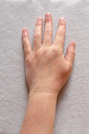 Wrinkled skin on a woman's hand, health and beauty concept.の写真素材