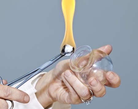 Applying cupping therapy in traditional chinese medicineの写真素材