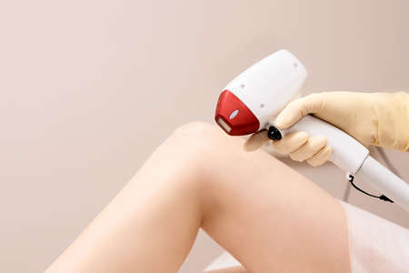 Laser turbo epilation. Treatment. Medical device.の写真素材