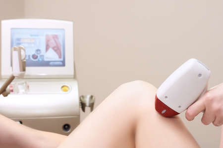 Laser turbo epilation. Medical procedure. Patients leg.の写真素材