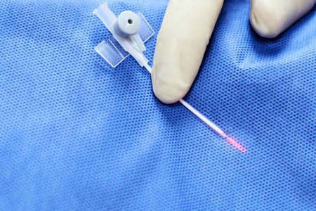 Laser removal veins. Varicose veins. Treatment couperose.の写真素材