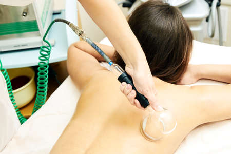 Medical procedure. Vacuum massage. Professional doctor.の写真素材