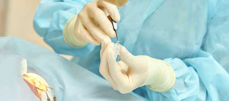 Ophthalmology laser microscope operation. Doctor in clinic. Patient eye treatment. Myopia and...