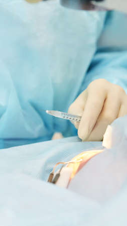 Ophthalmology laser microscope operation. Doctor in clinic. Patient eye treatment. Myopia and cataract removal.の写真素材