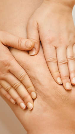 Cellulite leg woman pinch. Test fat hips treatment. Over weight liposuction. Remove striae.の写真素材