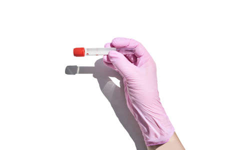 Hand in gloves holding test tube. Medical equipment.