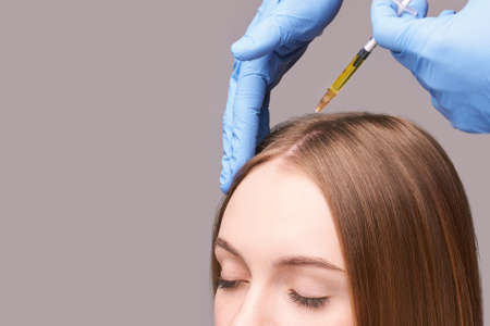 Doctor hands in protective medical gloves. Hair injection. Pretty young woman. Face anti age treatment. Cosmetology clinic. Medical concept. Head rejuvenation. Rich scalp yellow fillerの写真素材