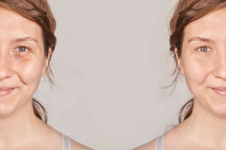 Pretty mature girl. Before and after portrait. Anti wrincle healthy therapy. Black circle under eyes. Collagen cream. Cosmetology rejuvenation. Beauty model. Procedure result.の写真素材