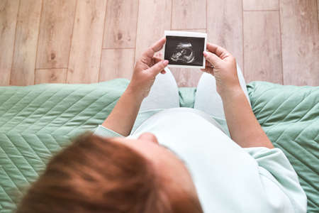 Pregnant belly with ultrasound result picture. Woman see unborned kid face. Waiting baby. Expecting child health therapy. Gynecologist checkの写真素材