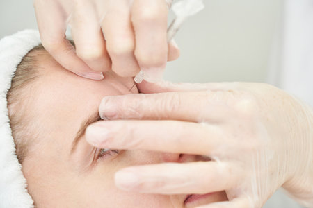 Injection at spa salon. Doctor hands in gloves. Closeup. Pretty female patient. Beauty treatment. Healthy skin procedure. Young women face. Plasmolifting rejuvenationの写真素材