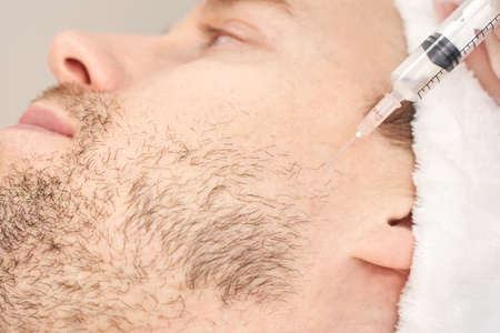 Injection at spa salon. Doctor hands in gloves. Closeup. Pretty male patient. Beauty treatment. Healthy skin procedure. Young man face. Plasmolifting rejuvenationの写真素材