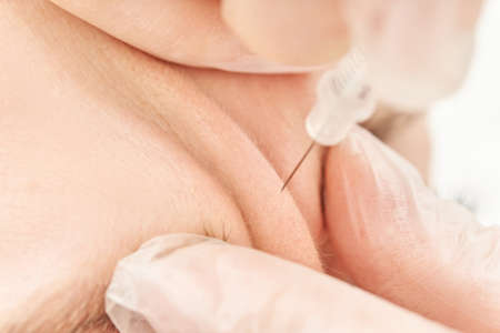 Injection at spa salon. Doctor hands in gloves. Closeup. Pretty female patient. Beauty treatment....