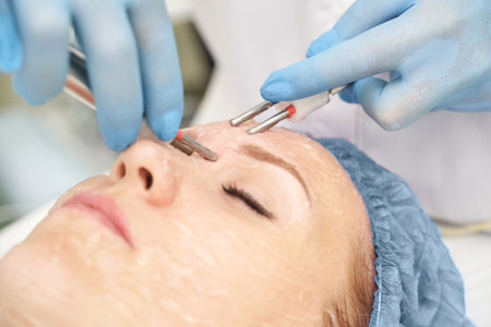 Dermatology anti age treatment. Microcurrent medicine procedure. Woman skin care. Aesthetic peeling...