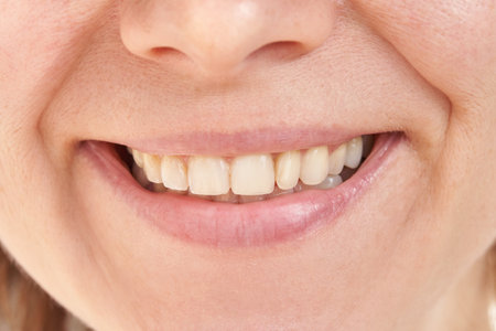 Close-up of a smiling mouth displaying natural teeth and lips in a candid expression with subtle...