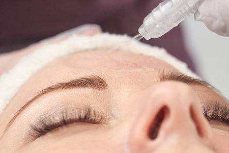 Female receiving skin treatment at spa, close up of procedure on forehead, beauty and skincare...