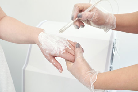Female hand receiving cosmetic treatment with cream applied by gloved professional.の写真素材