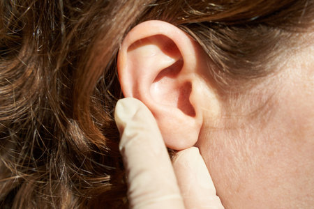 Female caucasian adult ear examined by gloved hand in close-up image highlighting ear health.の写真素材
