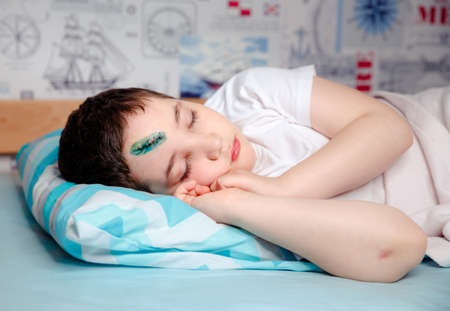 A child with a head injury is sleeping on a bed in his room. The surgeon stitched the skin on his forehead.The concept of safe active recreation and safety in the citys playgroundsの写真素材