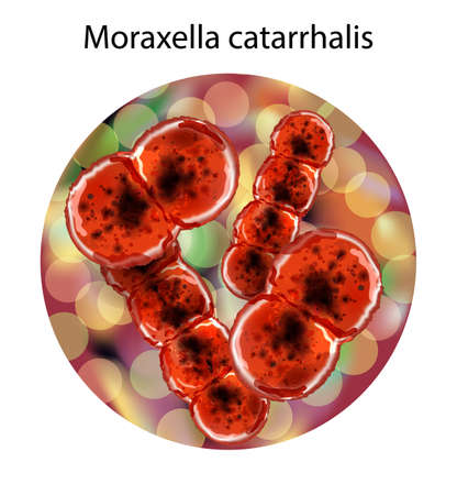 moraxella catarrhalis r view of some bacteria or cells under a microscope