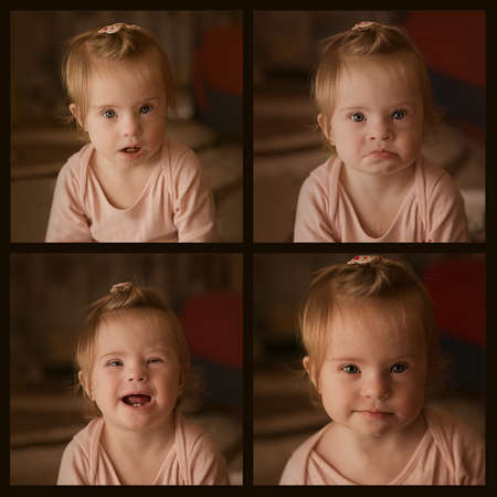 Emotions of a little girl with Down syndromeの写真素材
