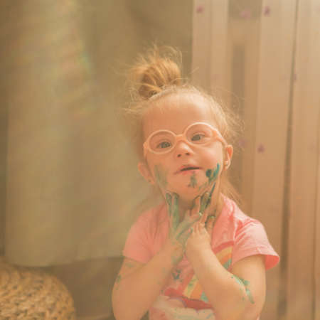 beautiful girl with Down syndrome on the beach