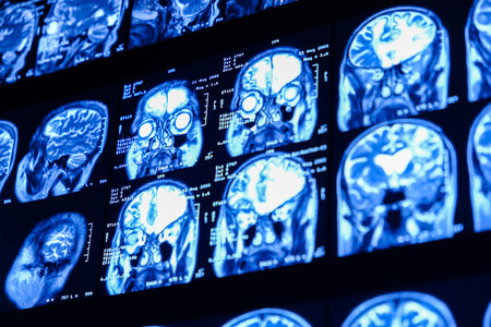 Close-up of CT scan with brain. Medicine, science and education MRI brain background. Magnetic resonance imaging. Tomography shot.の写真素材