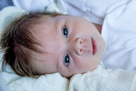 Two Week Old Baby small Lying In Crib, Close-Up Of Face With Newborn Acne skin