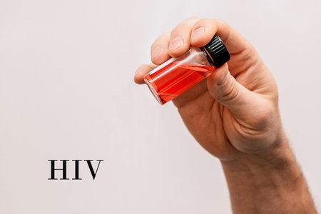 Laboratory Assistant Hand Holds test tube, Medical Problem of HIV Virus Pandemic